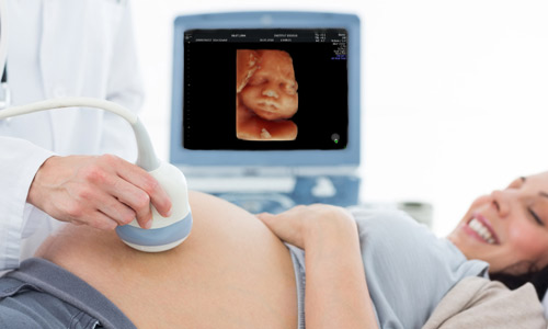 4D-5D Ultrasound - Share your experience