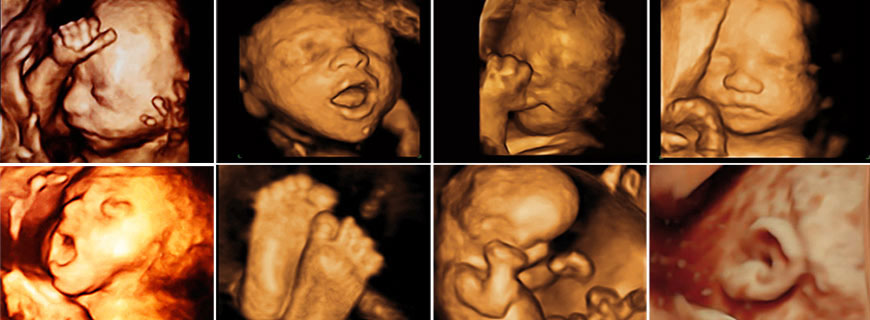 4D-5D Ultrasound - Request a quote