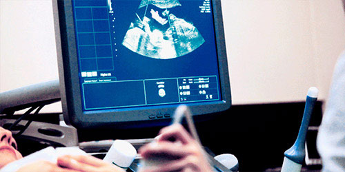 Diagnostic testing - Prenatal diagnosis
