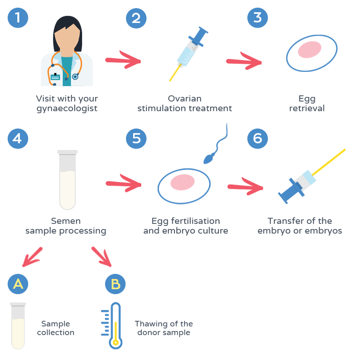 In Vitro Fertilization Ivf Process And Embryo Transfer 