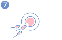 Egg donation - Egg fertilisation and embryo culture