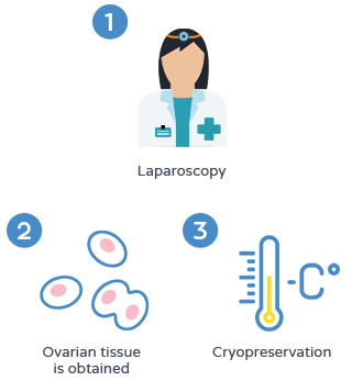 Fertility preservation - Ovarian tissue cryopreservation