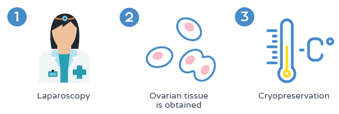 Fertility preservation - Ovarian tissue cryopreservation