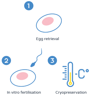 Fertility preservation - Embryo cryopreservation