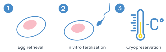 Fertility preservation - Embryo cryopreservation