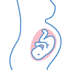 Nutrition Unit - If you are pregnant and have gestational diabetes, or are overweight or obese