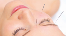 Other services - Acupuncture